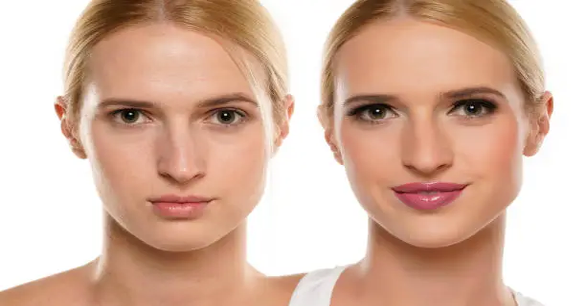 Lip Flip Before and After